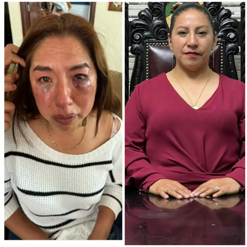 ¡Justicia para Míriam! Protestas en Capulhuac Exigen la Destitución de la Alcaldesa Selene Hernández Herrera tras Agresión
