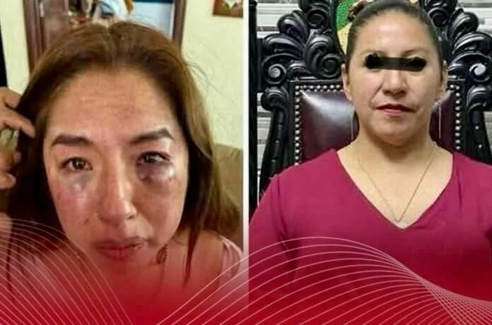 Capturan a Presidenta Municipal de Capulhuac Selenne “N”por Agresión Física a Trabajadora del DIF